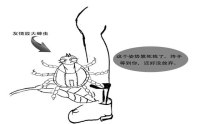 夏秋郊游谨防蜱虫叮咬